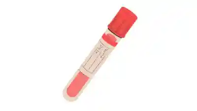 Qué es la hepatitis A, cómo se contagia y los síntomas.