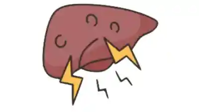 Qué es la hepatitis A, cómo se contagia y los síntomas.