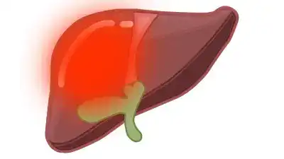 Qué es el té verde y como hay que tomarlo para evitar la toxicidad hepática.