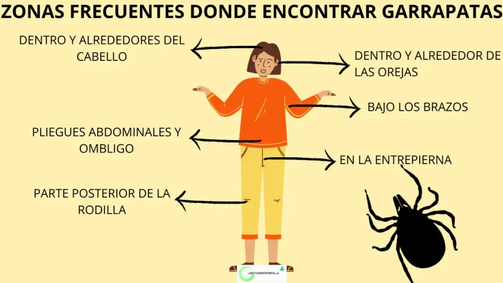 Picaduras de garrapatas en humanos: zonas a revisar.