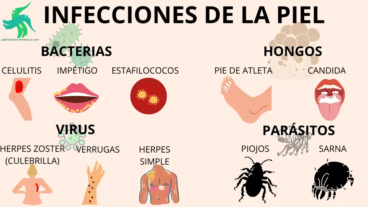 Cómo mantener una piel sana, rutinas para una piel sana y bonita para evitar las infecciones