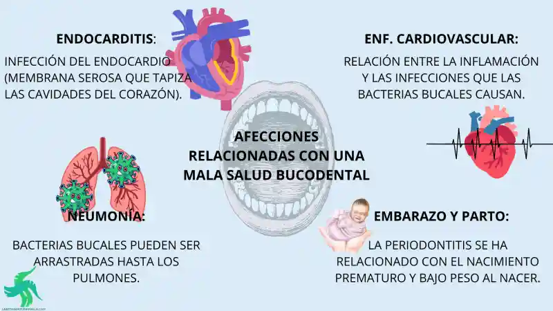 qué es la salud bucodental, prevención, importancia, salud general
