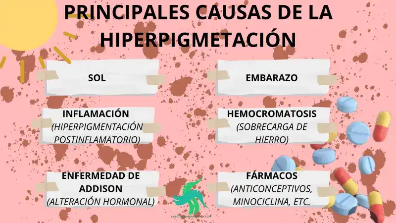 Manchas o hiperpigmentaciones: manchas en la piel, tipos de manchas en la piel,como se forman las manchas en la piel, ¿cuándo hay que preocuparse por una mancha en la piel