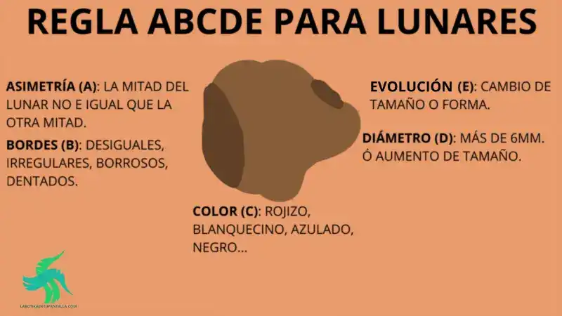 Manchas o hiperpigmentaciones: manchas en la piel, tipos de manchas en la piel,como se forman las manchas en la piel, ¿cuándo hay que preocuparse por una mancha en la piel