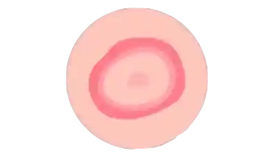 Enfermedad de lyme: prevención de las picaduras de garrapatas.