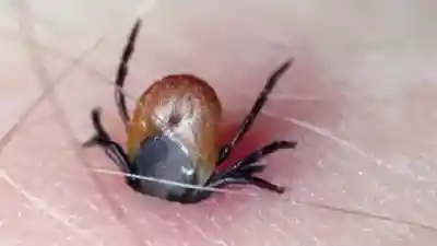 Enfermedad de lyme: prevención de las picaduras de garrapatas.