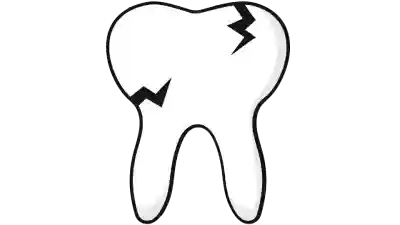 Salud bucodental, prevención de caries, enfermedad periodontal, Edentulismo, un buen cepillado previene complicaciones