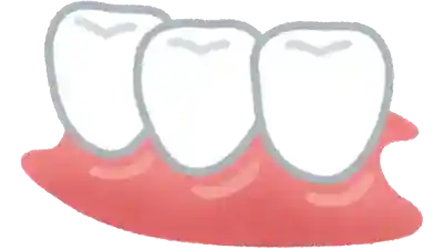 Salud bucodental, prevención de caries, enfermedad periodontal, Edentulismo, un buen cepillado previene complicaciones