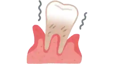 Salud bucodental, prevención de caries, enfermedad periodontal, Edentulismo, un buen cepillado previene complicaciones
