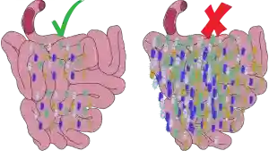 Microbiota intestinal, como funciona en microbioma, probióticos y probióticos