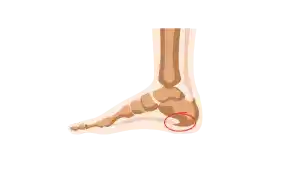 Bienestar de los pies, como cuidar de tus pies, pies sanos cuerpos sano, prevenir molestias de los pies, espolón, ampollas en los pies, neuroma de Morton, fascitis plantar. Trucos para el cuidado de tus pies