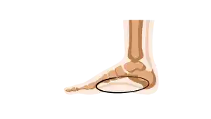 Bienestar de los pies, como cuidar de tus pies, pies sanos cuerpos sano, prevenir molestias de los pies, espolón, ampollas en los pies, neuroma de Morton, fascitis plantar. Trucos para el cuidado de tus pies