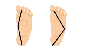 Bienestar de los pies, como cuidar de tus pies, pies sanos cuerpos sano, prevenir molestias de los pies, espolón, ampollas en los pies, neuroma de Morton, fascitis plantar. Trucos para el cuidado de tus pies